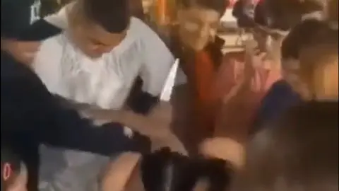 Fiesta termina en tragedia: Queda tuerto por empujar en el pastel