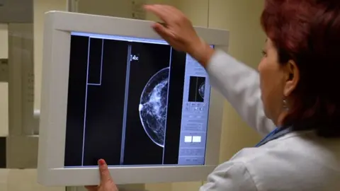 Sudor, nuevo método para detectar cáncer de mama