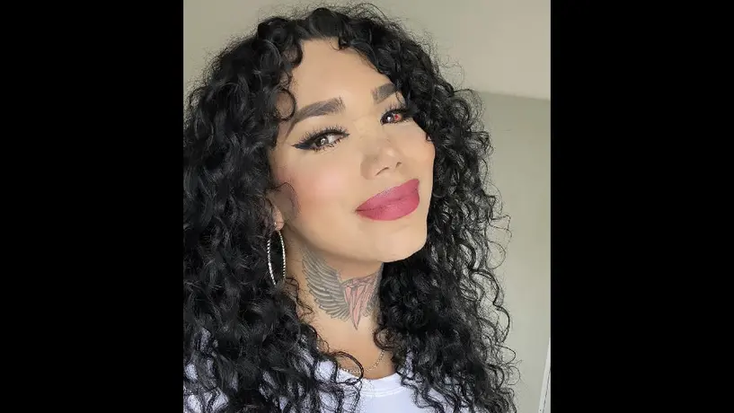 ¡Qué buen corazón! Paola Suárez afirma que perdonó a su expareja tras golpearla