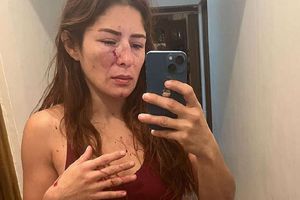 Exdeportista mexicana denuncia agresiones físicas de su pareja