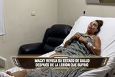 ‘Exatlón México’: Macky González está hospitaliza tras sufrir una fuerte infección dentro del reality