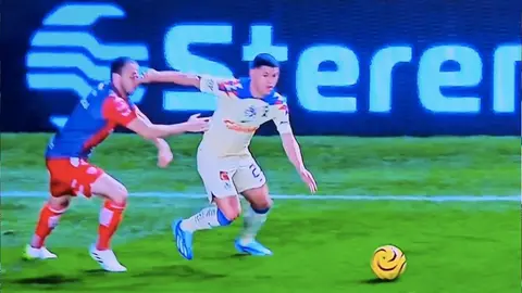 Alejandro Mayorga muestra cómo quedó su ojo luego del golpe de Richard Sánchez