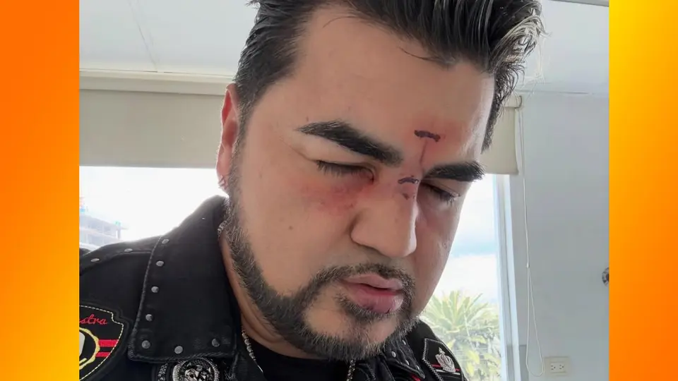 ¿Golpeado? ‘El Mimoso’ preocupa a fans tras publicar foto con el rostro herido