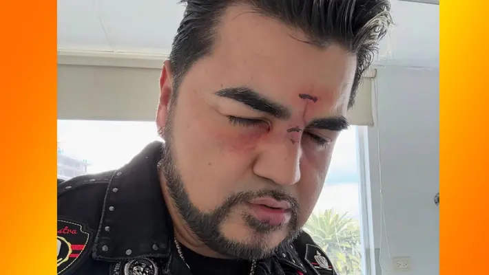 ¿Golpeado? ‘El Mimoso’ preocupa a fans tras publicar foto con el rostro herido