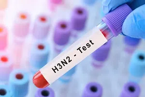 ¿Tengo gripe H3N2 tipo K? Así es la prueba que detecta esta “súper gripe”