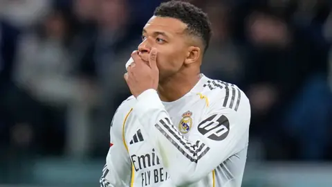 Kylian Mbappé es duda para el duelo ante Manchester City