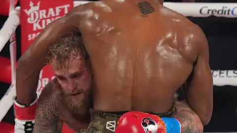 Jake Paul muestra doble fractura de mandíbula tras pelea contra Anthony Joshua