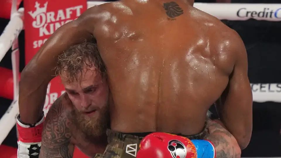 Jake Paul muestra doble fractura de mandíbula tras pelea contra Anthony Joshua