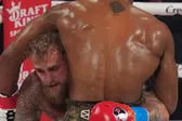 Jake Paul muestra doble fractura de mandíbula tras pelea contra Anthony Joshua
