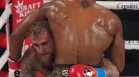 Jake Paul muestra doble fractura de mandíbula tras pelea contra Anthony Joshua