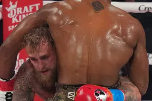 Jake Paul muestra doble fractura de mandíbula tras pelea contra Anthony Joshua