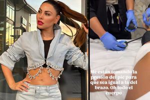 Gaby Ramírez sufre brutal ataque de perro: “Me arrancó un pedazo de carne”