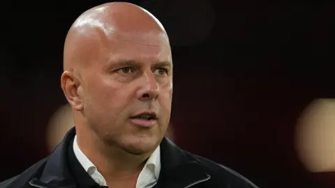 Exfutbolistas del Liverpool pierden la paciencia con Arne Slot luego de la eliminación en la Copa de la Liga
