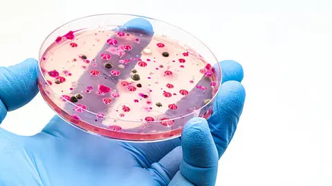 La infección por Candida auris puede agravarse en personas hospitalizadas o con sistemas inmunológicos debilitados. / iStock