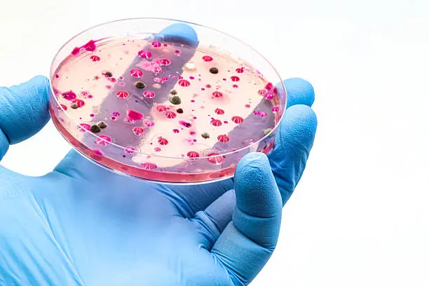 La infección por Candida auris puede agravarse en personas hospitalizadas o con sistemas inmunológicos debilitados. / iStock
