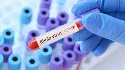 ¿Cuáles son los síntomas del ébola? OMS lanza alerta por nuevo brote