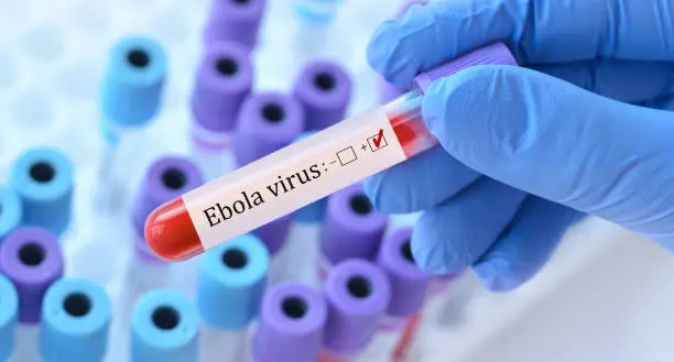 El brote de ébola detectado en la República Democrática del Congo encendió nuevamente las alertas sanitarias internacionales. / iStock