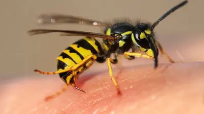 Qué hacer si te pica una abeja: síntomas, primeros auxilios y señales de alerta