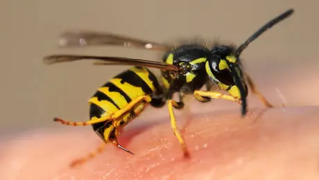 Qué hacer si te pica una abeja: síntomas, primeros auxilios y señales de alerta