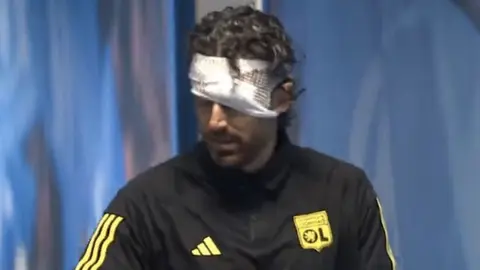 Fabio Grosso acaba ensangrentado tras agresión de ultras; Marsella vs Lyon fue suspendido