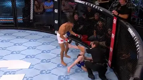 Peleador de MMA sufre escalofriante fractura en pleno combate
