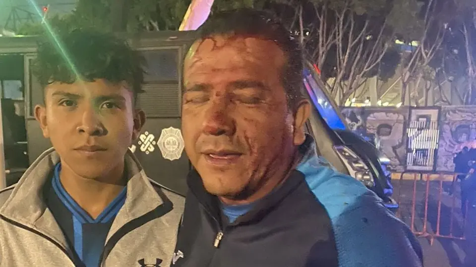 Aficionado de Cruz Azul aparece ensangrentado y denuncia agresión de policía en el Azteca
