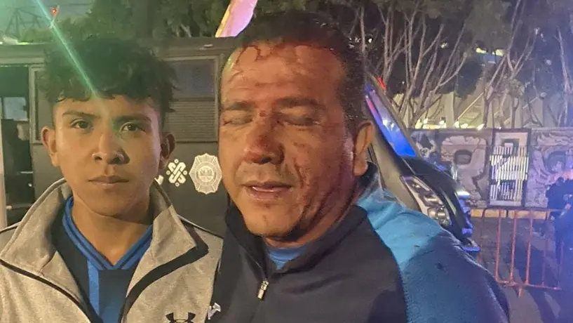 Aficionado de Cruz Azul aparece ensangrentado y denuncia agresión de policía en el Azteca