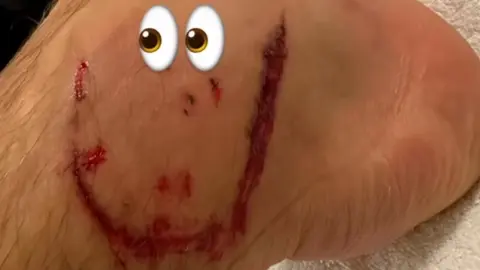 ¡Un recuerdito! Leon Goretzka comparte en redes heridas en el pie tras el partido ante México