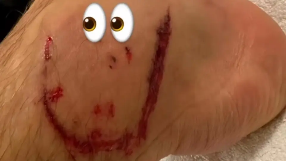 ¡Un recuerdito! Leon Goretzka comparte en redes heridas en el pie tras el partido ante México