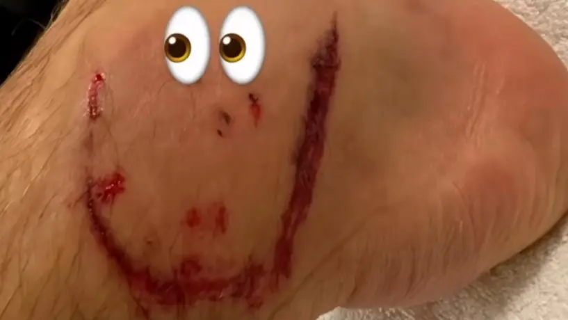 ¡Un recuerdito! Leon Goretzka comparte en redes heridas en el pie tras el partido ante México