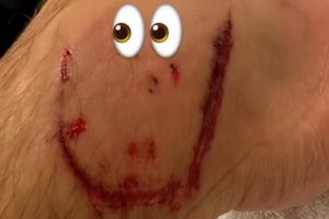 ¡Un recuerdito! Leon Goretzka comparte en redes heridas en el pie tras el partido ante México