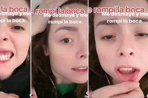 Maryfer Centeno sufre aparatoso accidente que casi la deja sin dientes