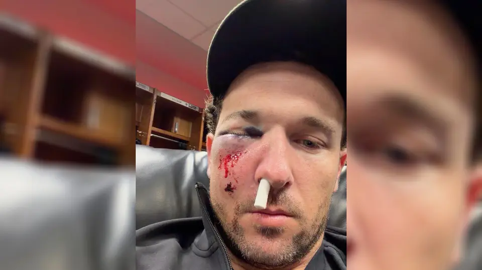Alex Bregman recibió el impacto en el ojo | Especial