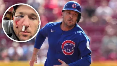 Alex Bregman recibe fuerte golpe en el rostro y es llevado al hospital