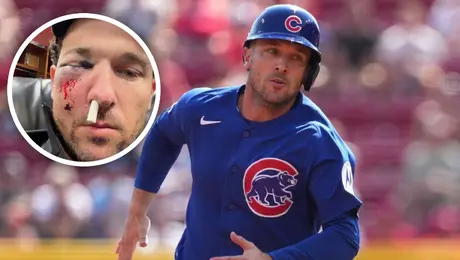Alex Bregman recibe fuerte golpe en el rostro y es llevado al hospital