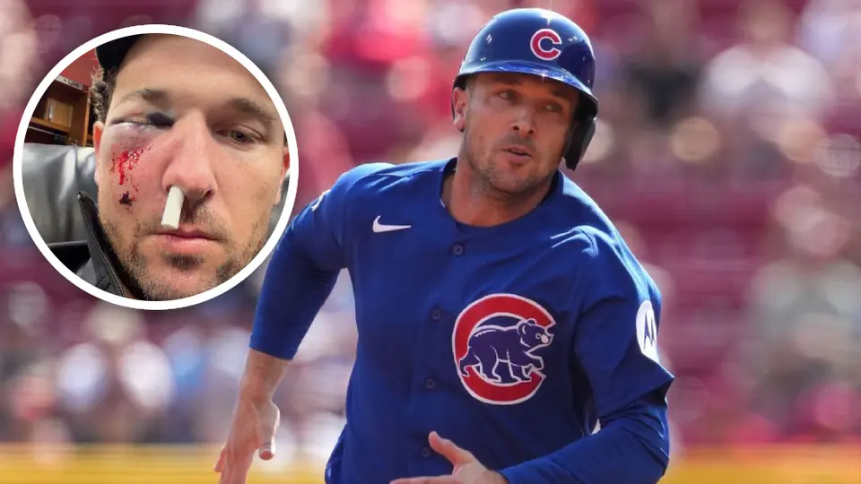 Alex Bregman recibe fuerte golpe en el rostro y es llevado al hospital