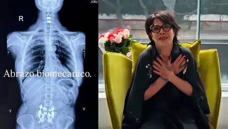 Alejandra Guzmán reaparece caminando y anuncia demanda contra médico tras su luxación de cadera