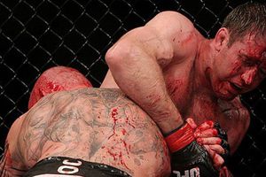 UFC: Muere la leyenda Stephan Bonnar