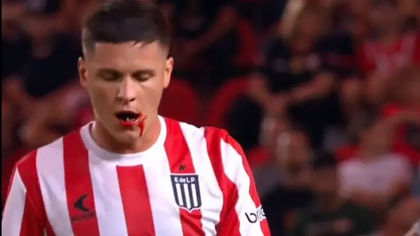 Jugador de Estudiantes de la Plata perdió tres dientes tras recibir 'codazo' de su rival