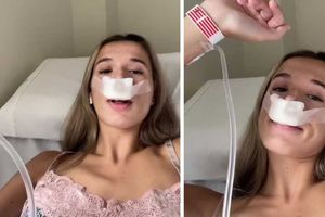 Influencer comparte Tiktok sobre su rinoplastia para que sus hijos “nazcan con linda nariz”