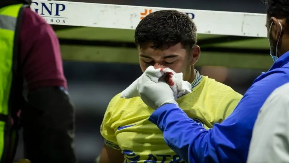 América: Así quedó Zendejas tras sufrir fractura en la nariz