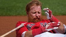 MLB: Justin Turner, de Red Sox, con el rostro golpeado; recibió 16 puntadas