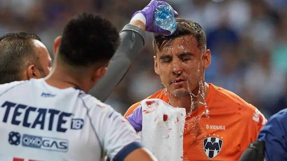 Luis Cárdenas muestra escalofriantes fotos de su fractura de nariz tras el Rayados vs Santos