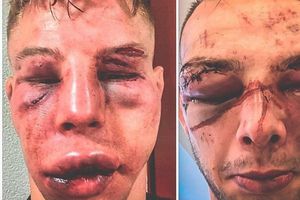 Video: Makarowski y Blezien terminaron desfigurados tras su pelea en MMA