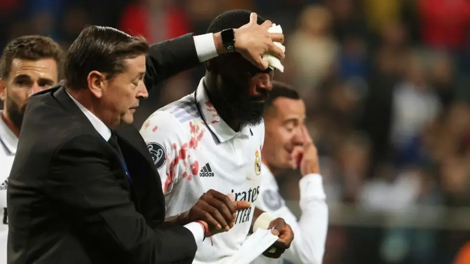 Real Madrid: Antonio Rüdiger recibió 20 puntos de sutura por el golpe que recibió
