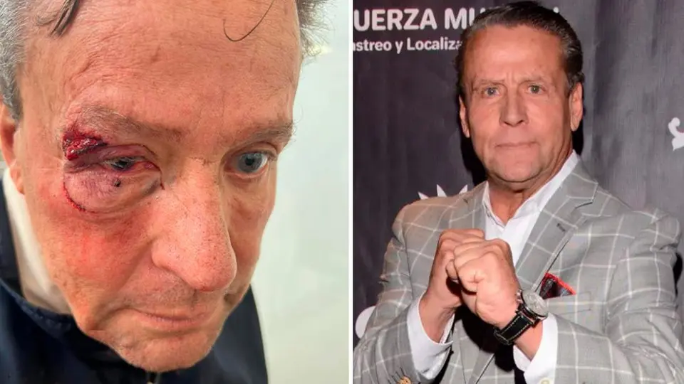 Alfredo Adame, brutalmente golpeado y con posible desprendimiento de retina