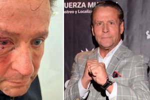 Alfredo Adame, brutalmente golpeado y con posible desprendimiento de retina