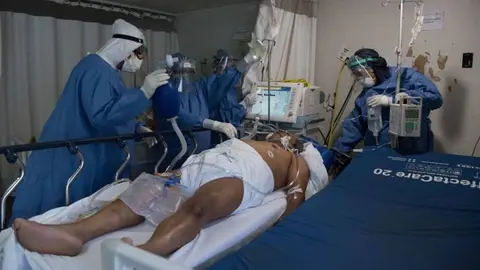COVID-19 en México: Se reportaron más de 34 mil contagios y 74 muertes en un día
