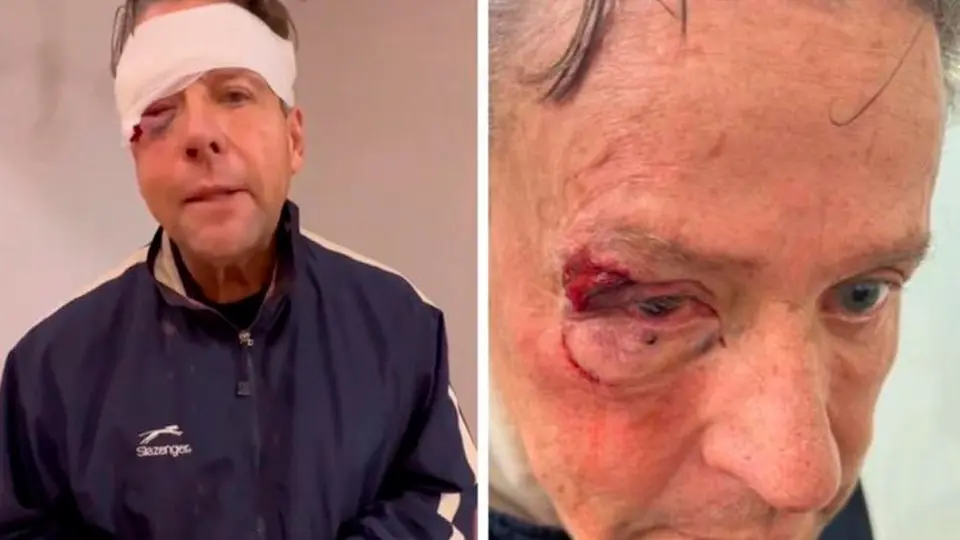 Alfredo Adame, irreconocible tras operación por brutal golpiza