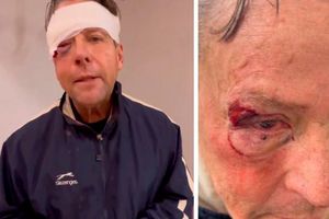 Alfredo Adame, irreconocible tras operación por brutal golpiza